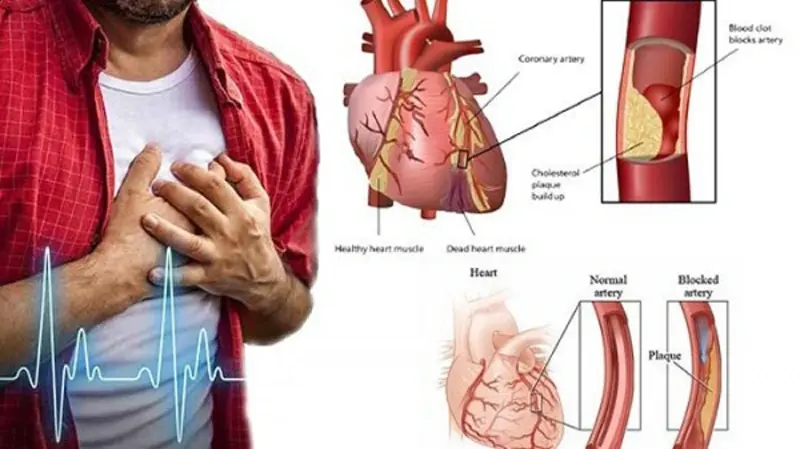 হার্টের ব্লক কী, কেন হয় এবং এর প্রতিকার কী