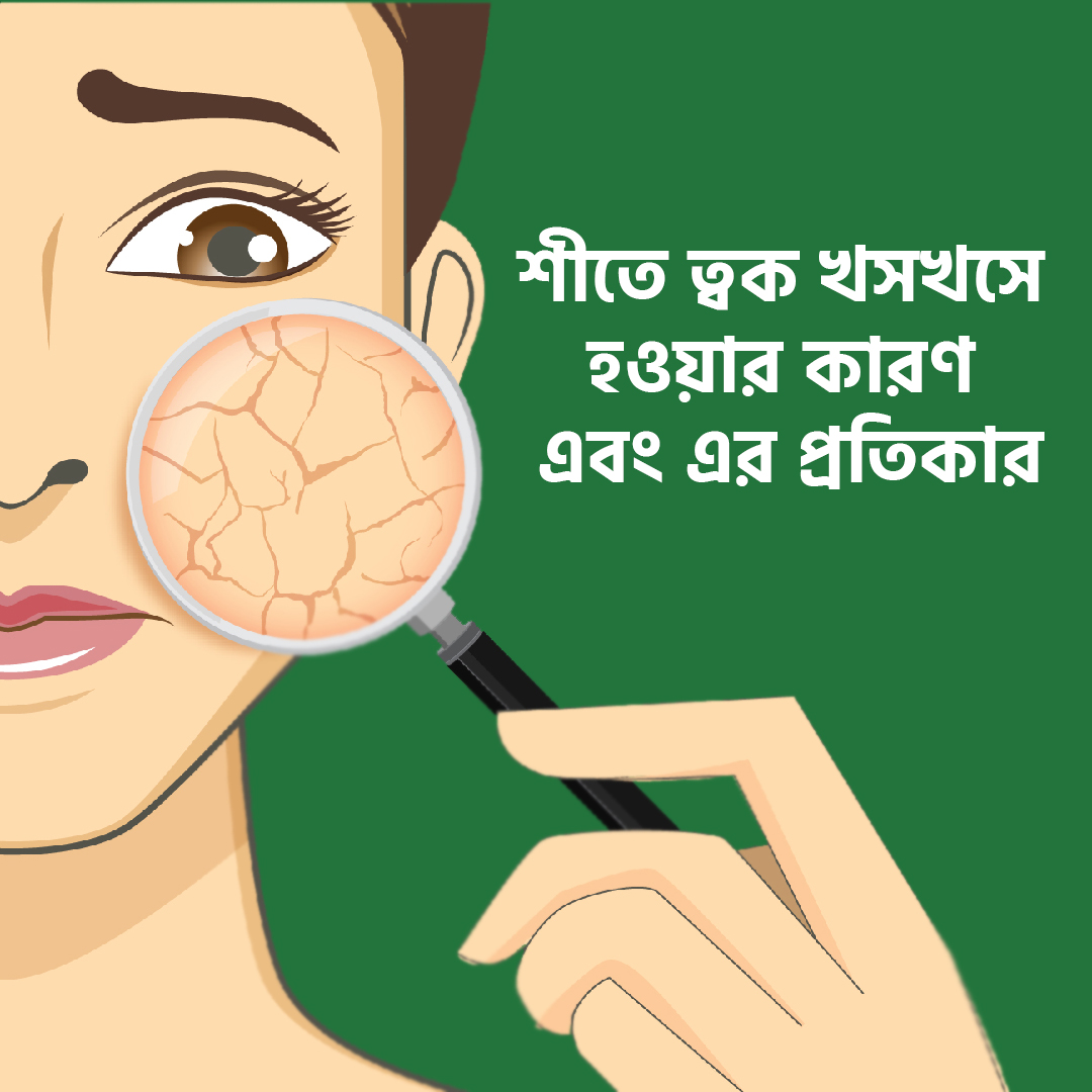 শীতে ত্বক খসখসে হওয়ার কারণ এবং এর প্রতিকার